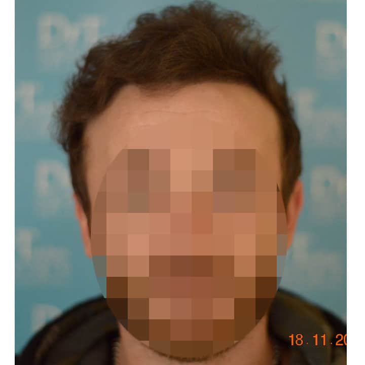 patient15_after