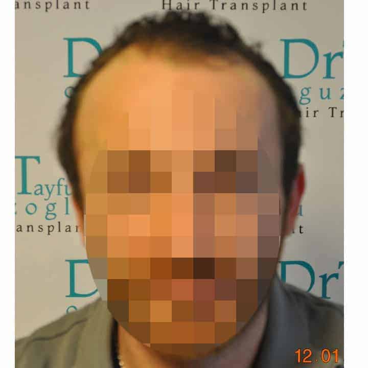 patient15_before
