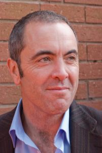 james_nesbitt_july_2008 celebrity hair transplant James Nesbitt 2008
