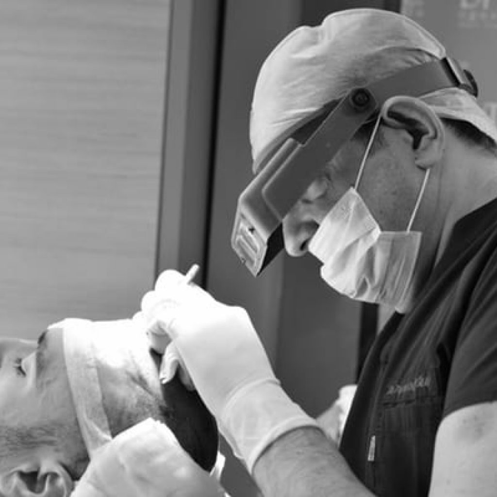 Post FUE Transplant Hair Care Tips