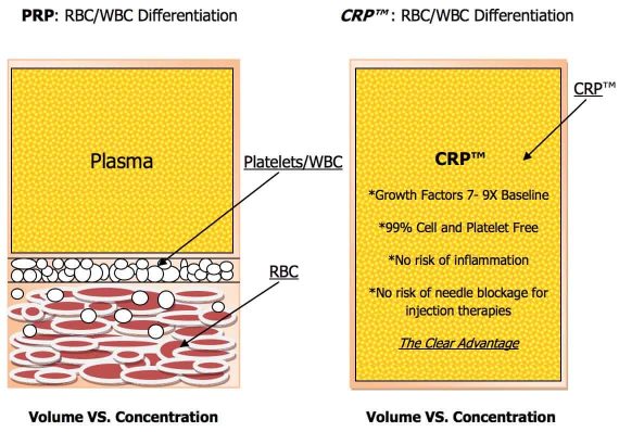 CRP vs PRP CRP vs PRP