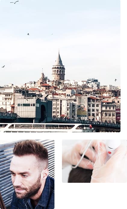 Complete Guide & Advice For Hair Transplant in Turkey - GetHair