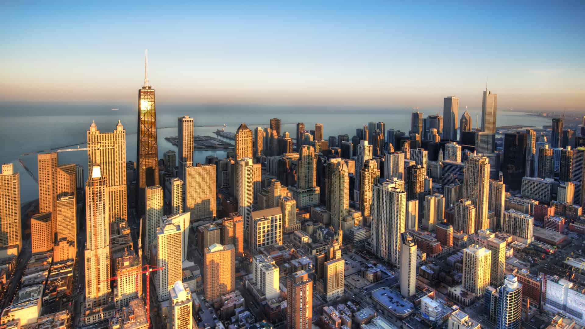 hair transplant in chicago