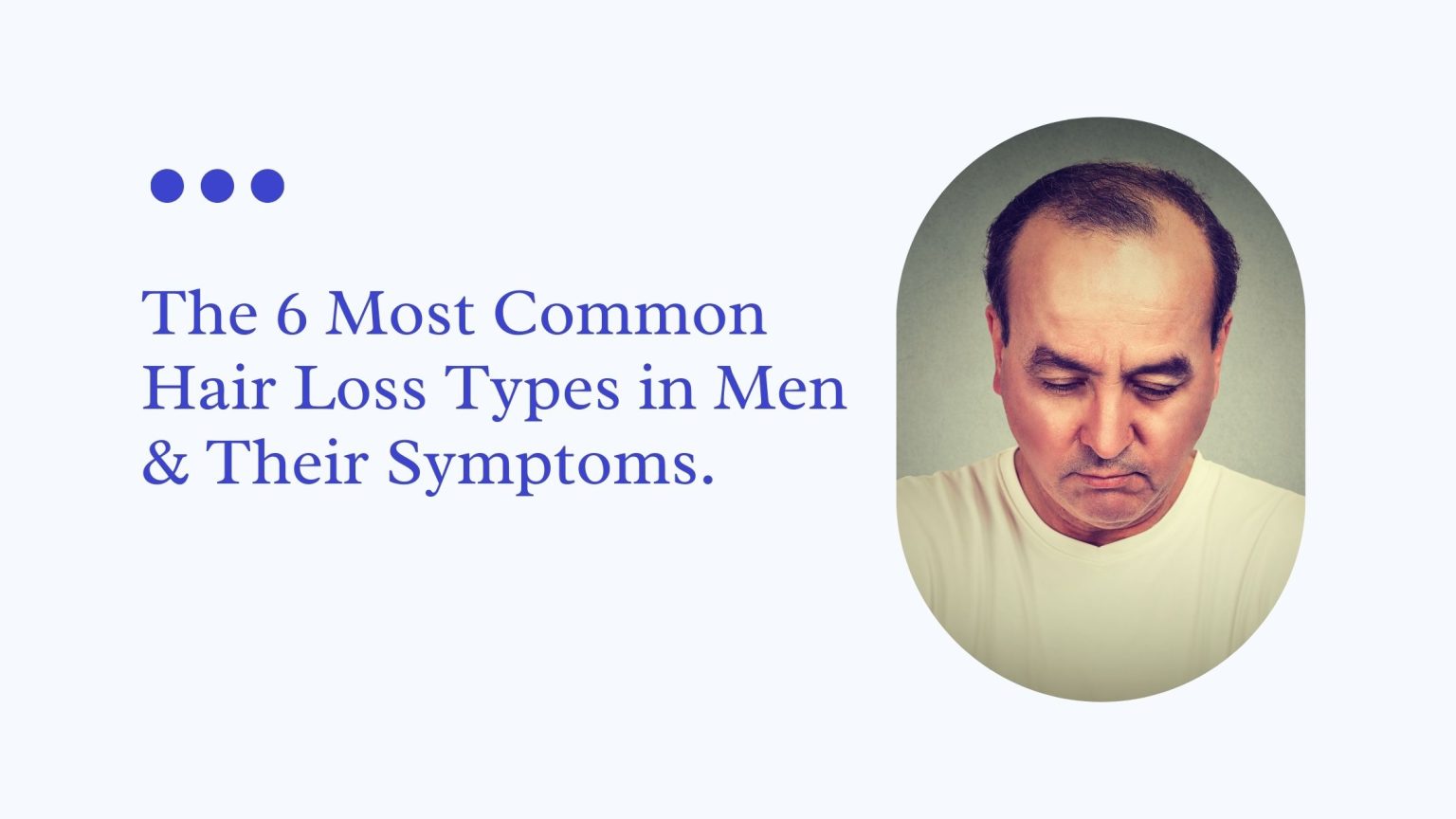 The 6 Most Common Hair Loss Types in Men & THeir Symptoms GetHair