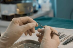 Surgeon's hands holding curved hair graft
